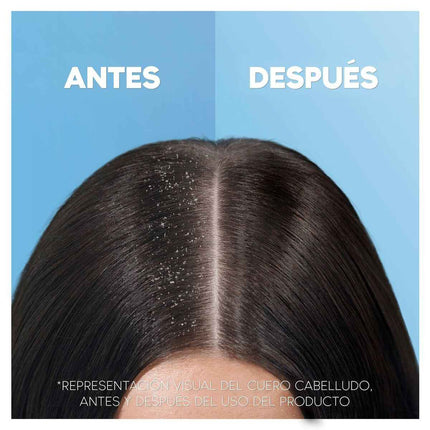 Shampoo Head & Shoulders H&S Clásico 1 L 2-in-1